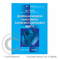 Biofragmentabilní anastomóza gastrointestinálneho traktu: Výpredaj