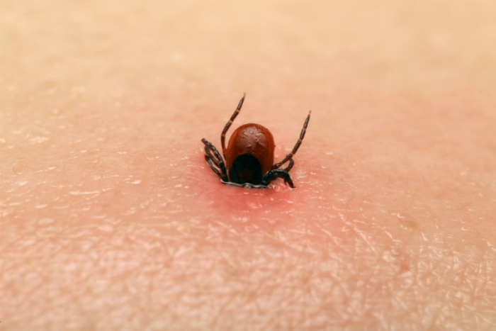 Domáci test na boréliu: S kliešťom do skúmavky Domáci test na boréliu: S kliešťom do skúmavky