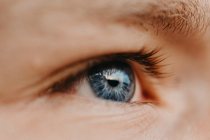 Jačmeň na oku − ako ho spoznať a ako sa ho zbaviť