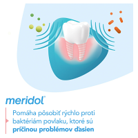 Obrázok 3/4