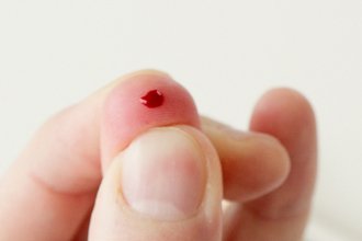 Na čo sú CRP testy a ako môžu pomôcť