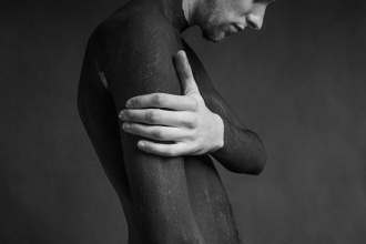 Vitiligo: Vráťte svojej pokožke prirodzenú farbu